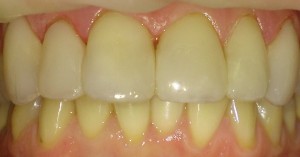 Atvejis 1.jpg poredaguota