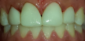 Atvejis 4.jpg po red